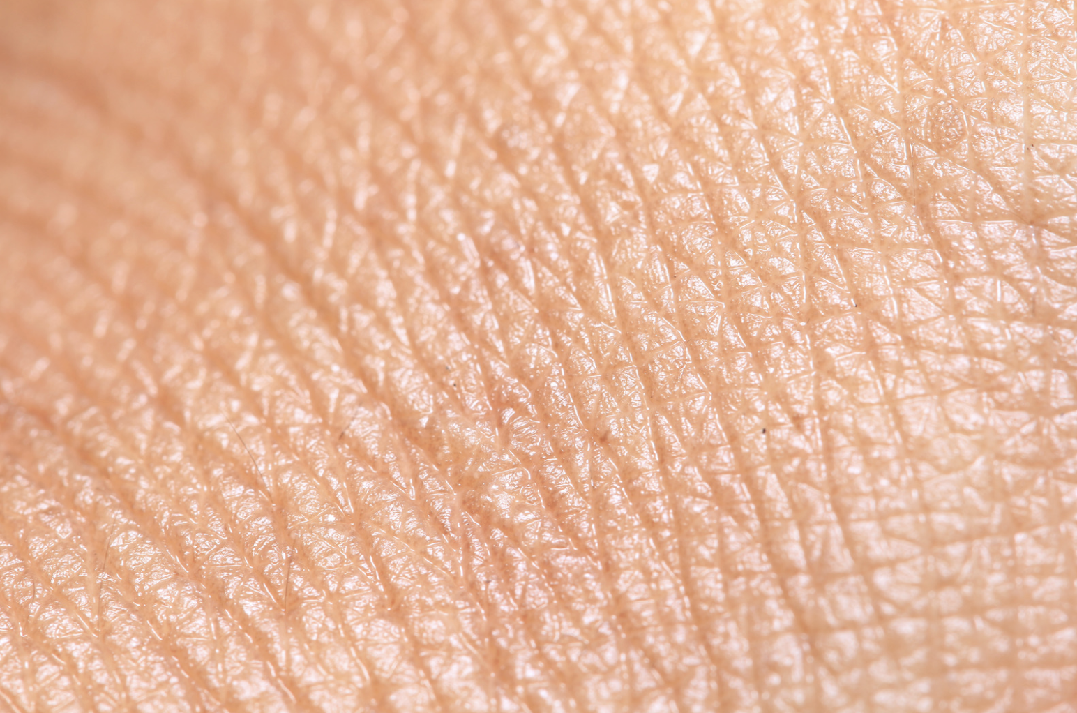 Sensitive Skin - Verve Medical Aesthetics - Facial Aesthetics in Bangor,  Belfast, Northern Ireland